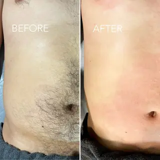 メンズ TREE WAX脱毛のエステ・リラクイメージ