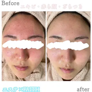 都度払い肌改善専門店 店長二上文香のエステ・リラクイメージ