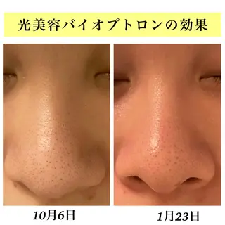 Bellesthe （ベルエステ）のエステ・リラクイメージ