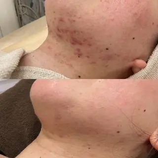 医療提携サロン新宿 La Lunaのエステ・リラクイメージ