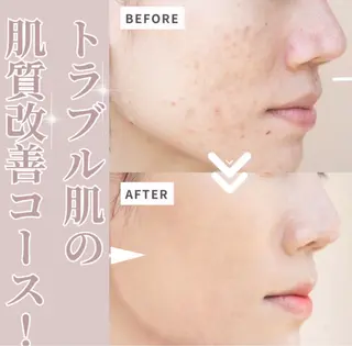 Meow！～トラブル肌専門ピーリング＆脱毛サロン～所属・トラブル肌改善🏥 Meow！🫧🫧のその他イメージ