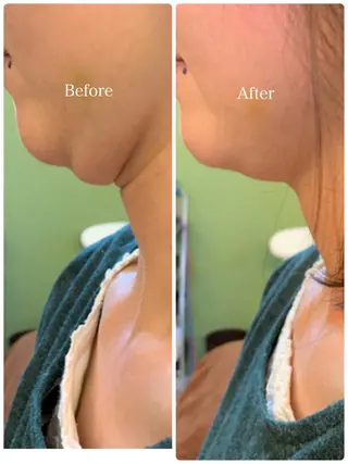 美容鍼 IKEZAKIのエステ・リラクイメージ