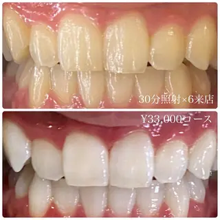 メンズ ホワイトニングルーム　川崎店所属・ホワイトニング ルーム　川崎店のその他イメージ