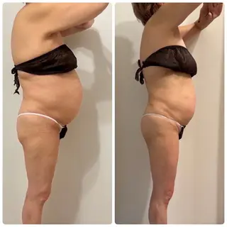 Re:Oasis所属・🦋Re:Oasis 近藤美貴【四谷】🦋のエステ・リラクイメージ