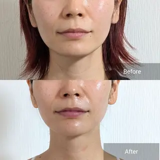 nail RiRi アトレナチュラのエステ・リラクイメージ