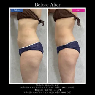 伊藤 正美のマツエク・マツパデザイン