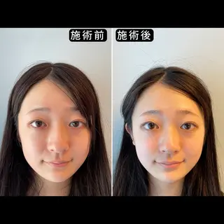 渋谷 小顔美容鍼 専門サロン YZのエステ・リラクイメージ