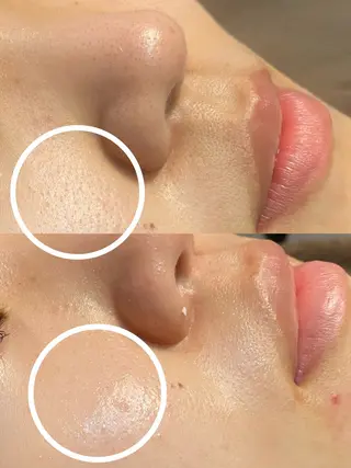 小顔の専門店　理想の小顔【リソウノコガオ】福島店所属・KOTO SALONのエステ・リラクイメージ