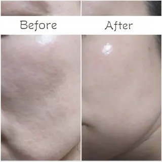 フェイシャル/毛穴 /シミ/たるみ東灘区のエステ・リラクイメージ