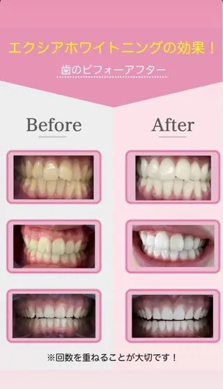 セルフホワイトニングサロン　エクシアホワイト西尾店所属・エクシアホワイト西尾 堀内恵のその他イメージ