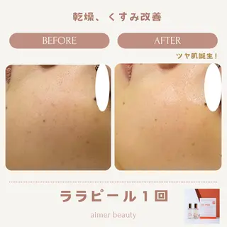 aimer beautyのエステ・リラクイメージ