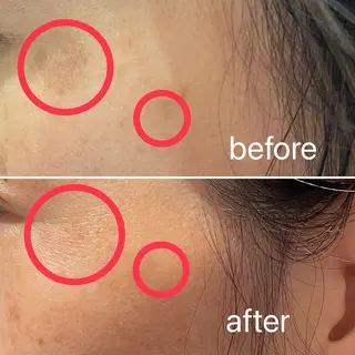 痛くないシミ取り 【荻窪】石橋のヘアスタイル