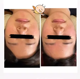 FLEUR 2号店のエステ・リラクイメージ