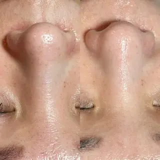 牧 由紀のエステ・リラクイメージ