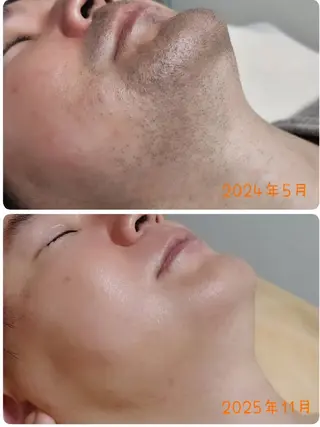 ブラジリアンワックス 脱毛 キナリのエステ・リラクイメージ