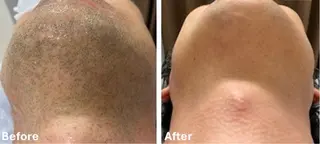 VANILLA SKY所属・VANILLA SKYのエステ・リラクイメージ