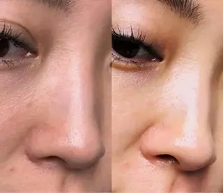 愛維美水光美肌専門店所属・愛維美水光美肌専門店 メンズレディースokのエステ・リラクイメージ