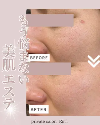private salon Rii'f.所属・private sa lon Rii'f.のエステ・リラクイメージ