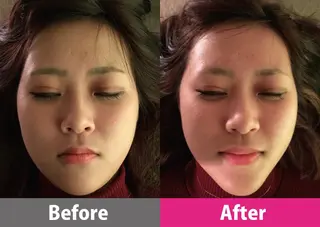 【顔面整体 アルソワート】のエステ・リラクイメージ