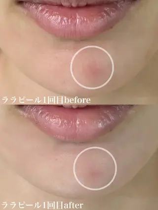 WHITE AQUA 北千住店のエステ・リラクイメージ