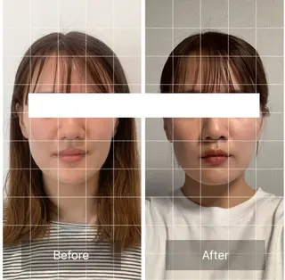 小顔と ヘッドスパのお店のエステ・リラクイメージ