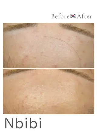 韓国🇰🇷価格 サロン_Nbibiのエステ・リラクイメージ