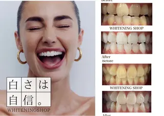 ホワイトニングショップ静岡葵区店所属・ホワイトニング ショップ葵区静岡駅店のその他イメージ