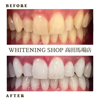 メンズ ホワイトニング ショップ高田馬場店のその他イメージ