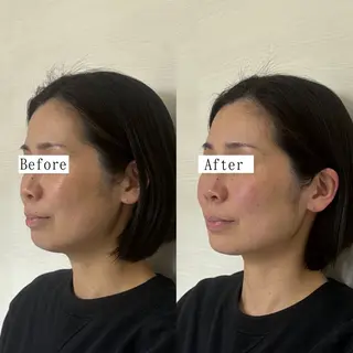 Private salon La.所属・Stellum 小顔矯正&ヘッドスパのエステ・リラクイメージ