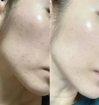 脱毛｜ピーリング ROOM.Sのエステ・リラクイメージ