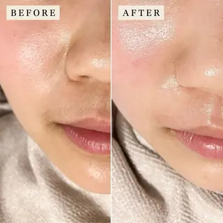 【産毛・眉毛ケア＆肌質改善サロン】＊BiBi＊beautysalon所属・眉･産毛専門BiBi 糸脱毛スレッティングのエステ・リラクイメージ