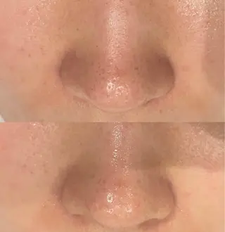 DeI'm   名古屋栄所属・小林 玲菜のエステ・リラクイメージ