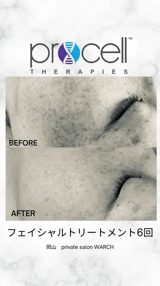 WARCH Marieのその他イメージ