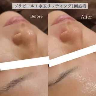 小顔美肌：ミアンカ 京阪モール本館1Fのエステ・リラクイメージ