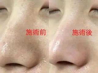 ミューズビューティー所属・山本 ゆりのエステ・リラクイメージ