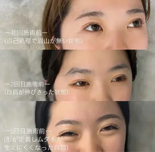 アイブロウ 【骨格診断📝 最強似合わせ眉✨】のエステ・リラクイメージ