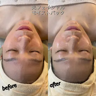 うなじ脱毛/美肌脱毛 LABELのエステ・リラクイメージ