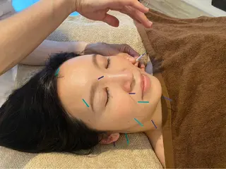 さくらんぼ鍼灸院所属・美容鍼&温活・免活 さくらんぼ鍼灸院のエステ・リラクイメージ