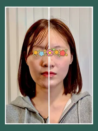 麻布十番/圧倒的小顔 毒出し美容🎀鍼灸のエステ・リラクイメージ