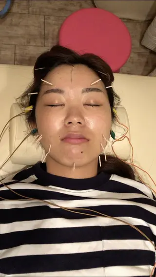 むくみたるみ専門☆ 美容鍼・小顔矯正のエステ・リラクイメージ