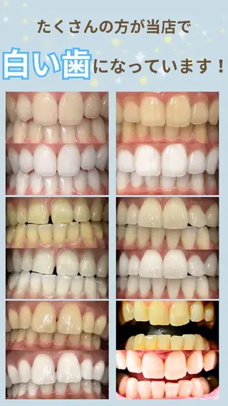 歯科提携セルフダック 宇都宮駒生店のエステ・リラクイメージ