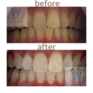 ホワイトニング ショップ本八幡店のエステ・リラクイメージ