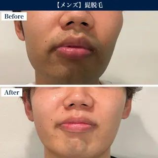 【メンズ脱毛・美肌】 SARA 恵比寿店のエステ・リラクイメージ