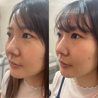 毛穴改善/脱毛 ネイル　川上久仁子のエステ・リラクイメージ