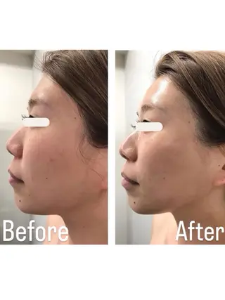 L.L.C所属・〜L.L.C〜 阿波座,中之島のエステ・リラクイメージ