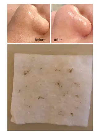 毛穴シミ改善専門 サロンド・ルパークのエステ・リラクイメージ