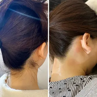 うなじ脱毛/美肌脱毛 LABELのエステ・リラクイメージ