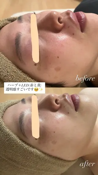 salon More所属・出口 玲菜のエステ・リラクイメージ