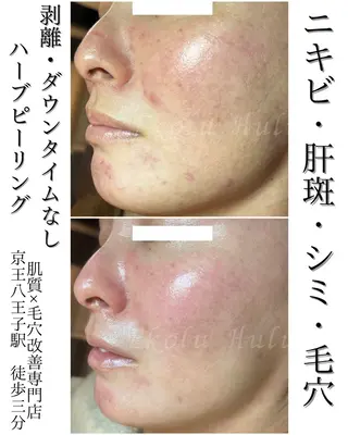 Ekolu Hulu所属・Ekolu Hulu エコル フルのエステ・リラクイメージ