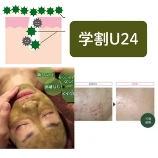 よもぎ蒸しエステサロン★yun所属・よもぎ蒸しサロン ゆんのエステ・リラクイメージ